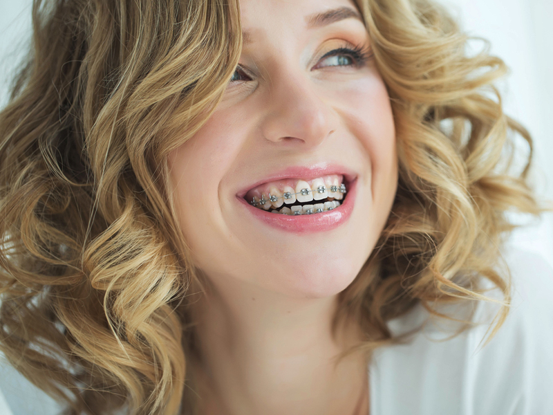 Premier Orthodontic Services for Adults in Columbus, Ohio