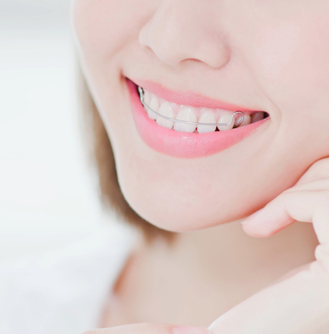 How quickly will your teeth shift if you don’t wear a retainer?