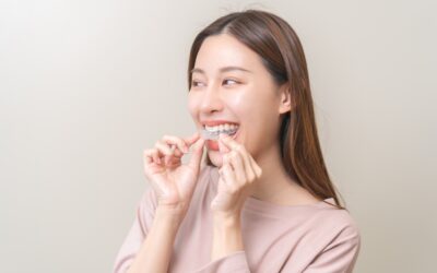 Retainer Program Columbus Ohio