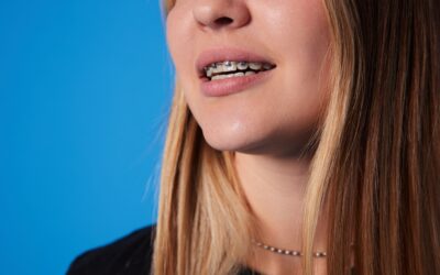 Are Braces Hard to Take Care Of?