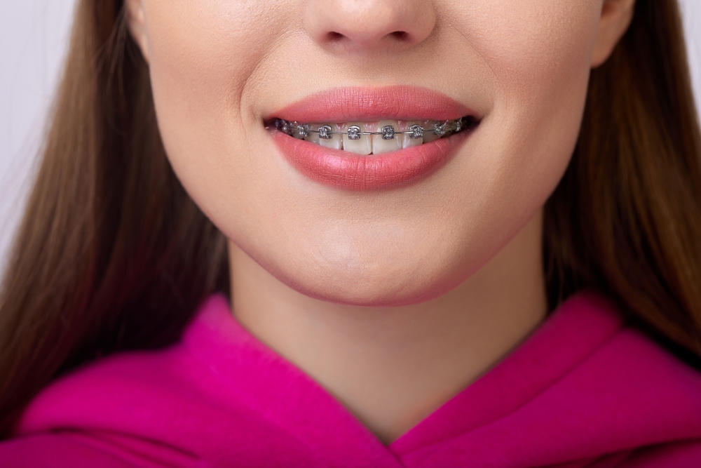 How orthodontics supports long-term dental health