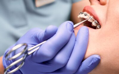 What Are the Signs That You May Need Orthodontic Treatment?