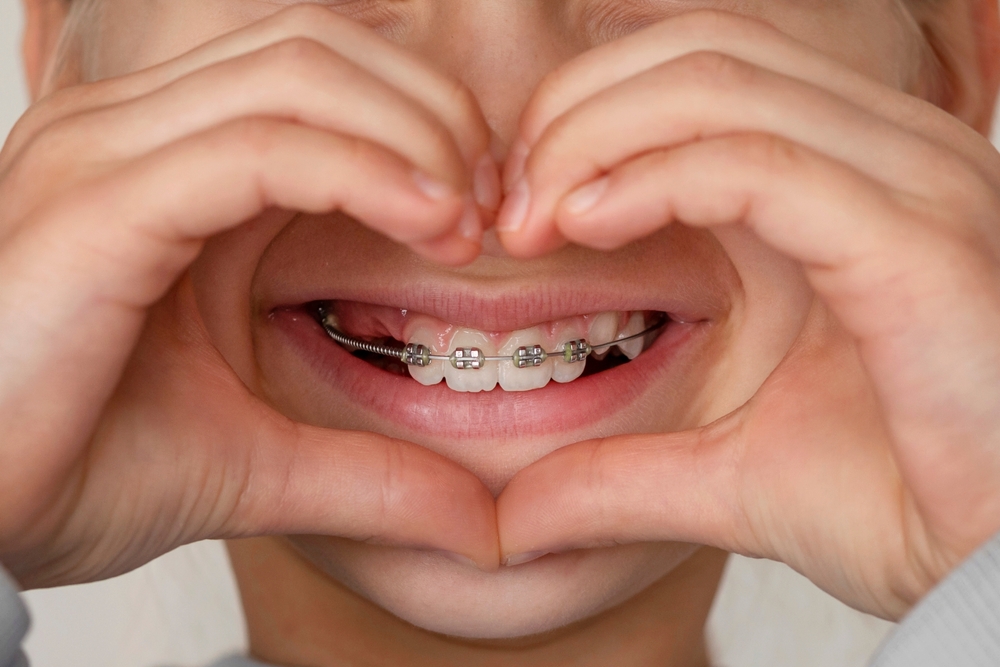 How orthodontics supports long-term dental health
